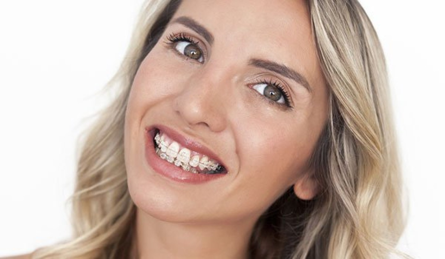 Orthodontist Montebello