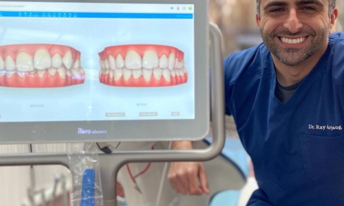 Invisalign-Technology