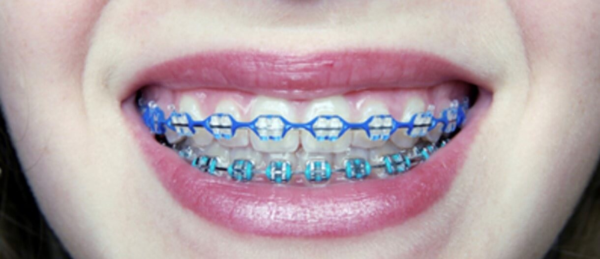 ¿Está mi hijo listo para los frenos? ¿Está mi hijo listo para los frenos?