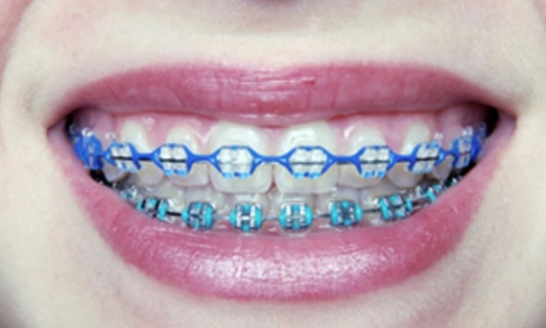 ¿Está mi hijo listo para los frenos? ¿Está mi hijo listo para los frenos?